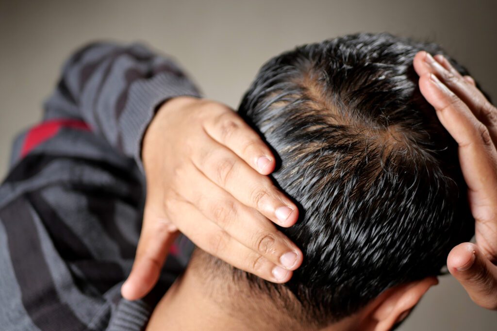 A man is gently caressing his hair while experiencing hair loss.