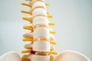 A close up of a model of the spine demonstrating spinal fractures.