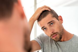 A man is experiencing hair loss as he looks at his reflection in the mirror.